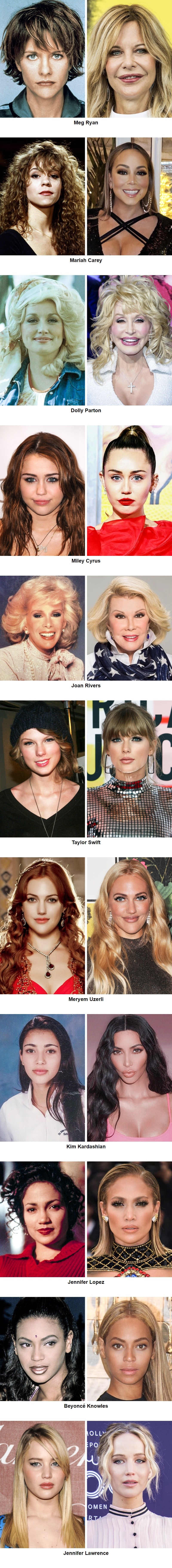 Usporedbe pokazuju kako su zvijezde izgledale prije, a kako nakon što su se počele igrati sa svojim izgledom