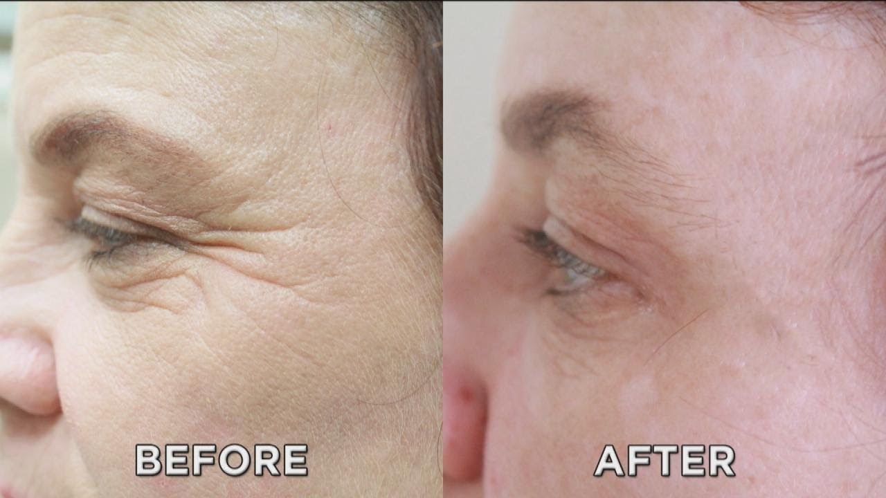 Tvrtka tvrdi da je razvila proizvod koji briše bore i podočnjake preko noći, evo kako su izgledali rezultati