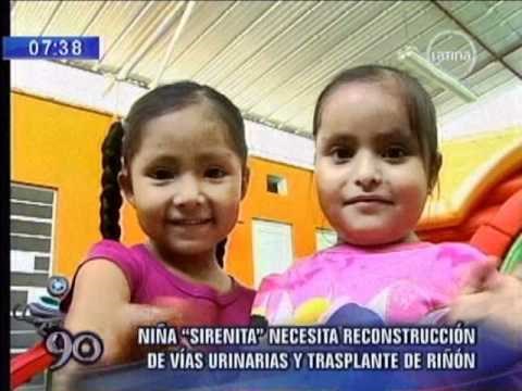 Djevojčica je prije 15 godina rođena sa spojenim nogama, pogledajte kako "mala sirena" danas izgleda