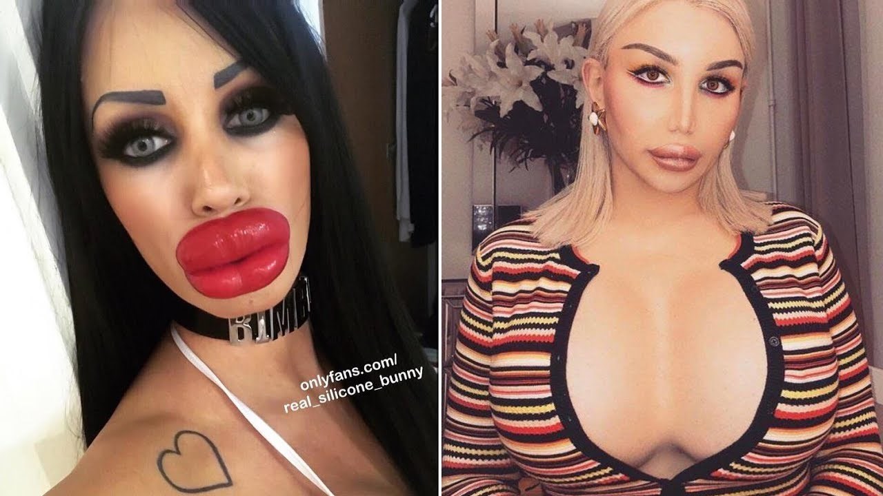 25 ljudi koji se sigurno kaju zbog onoga što su učinili svojim licima i tijelima