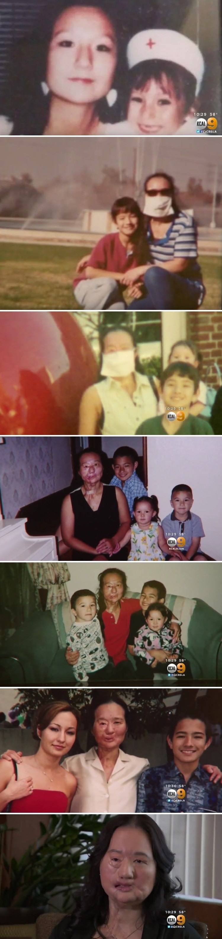 Ova žena je 12 godina krila svoje lice kako bi sakrila i pravu istinu o svome mužu