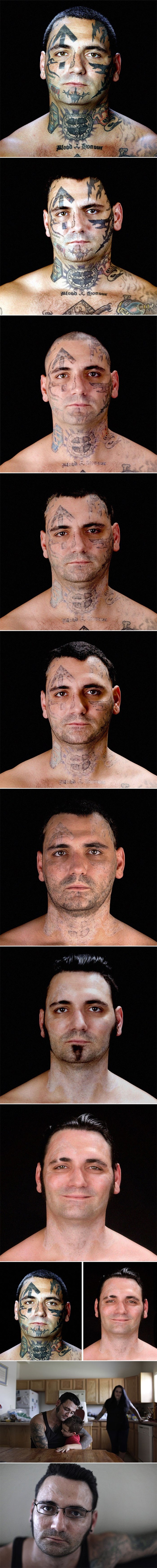 Bivši skinhead odlučio je napustiti rasističku organizaciju i ukloniti tetovaže. Pogledajte kako danas izgleda