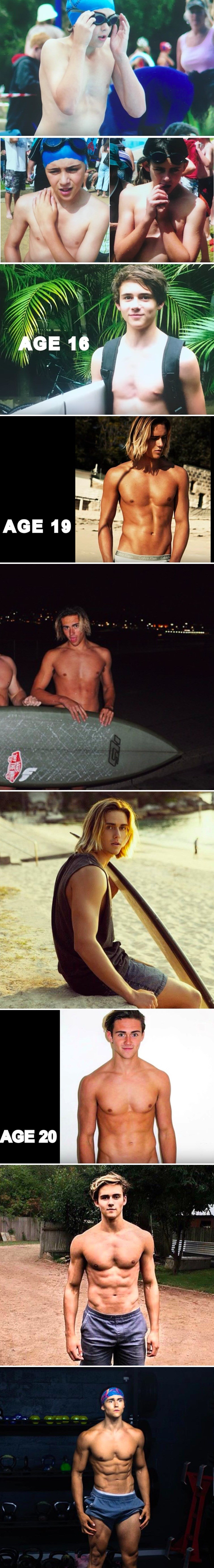 Zbog deformacije prsnog koša ovom su se dečki svi rugali, a onda ih je zadivio svojom transformacijom