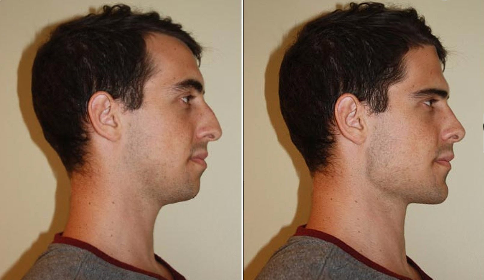 VIDEO Otvorio je fotku i u Photoshopu pokušao složiti "savršenog muškarca", je li uspio?