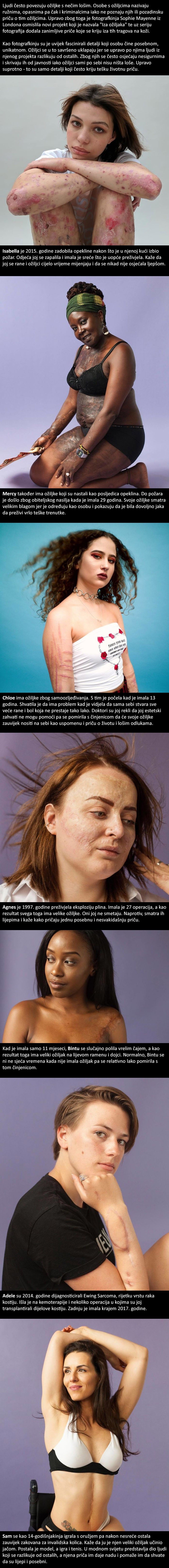 Mlada fotografkinja otkrila je životne priče ljudi čija su tijela prekrivena ožiljcima i ranama