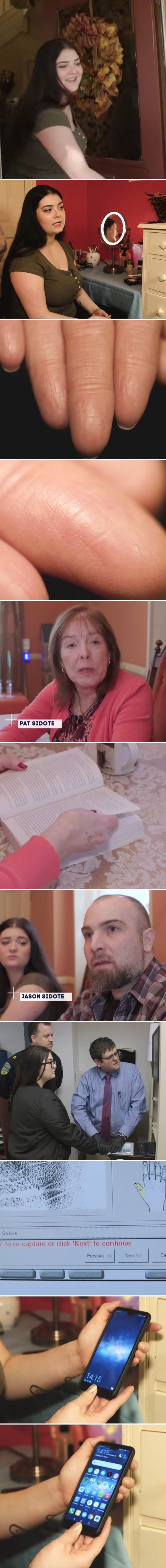 Ova djevojka nema otisak prstiju i to joj zagorčava život. Pogledajte kako izgledanju njeni dlanovi