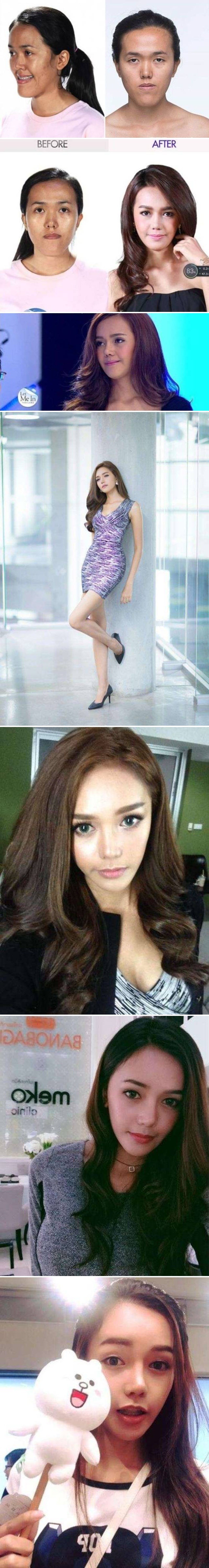 ČUDOTVORNA OPERACIJA Primjer ove djevojke dokazuje da u današnje vrijeme svi mogu biti lijepi