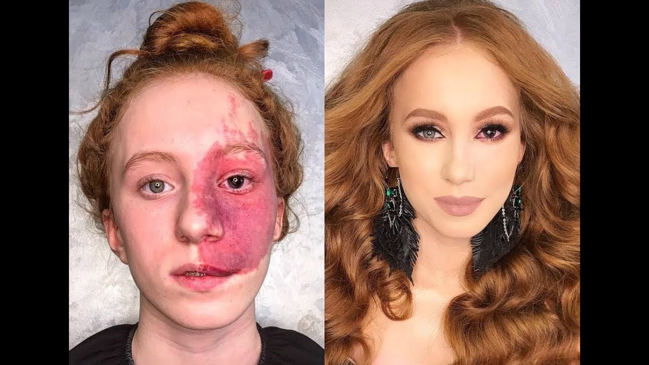 VIDEO Žena s kožnom promjenom na licu ušla je u salon i doživjela nevjerojatnu transformaciju