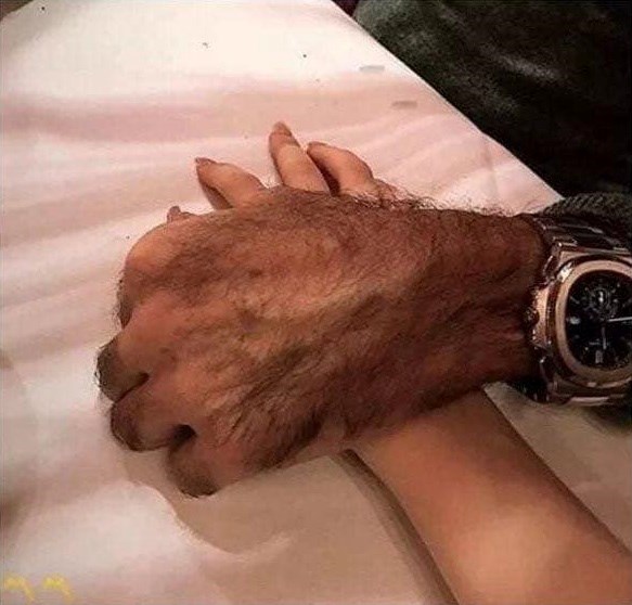 Oči varaju na prvi pogled: Jeste li i vi među onima koji su na ovoj slici vidjeli pseću šapu?