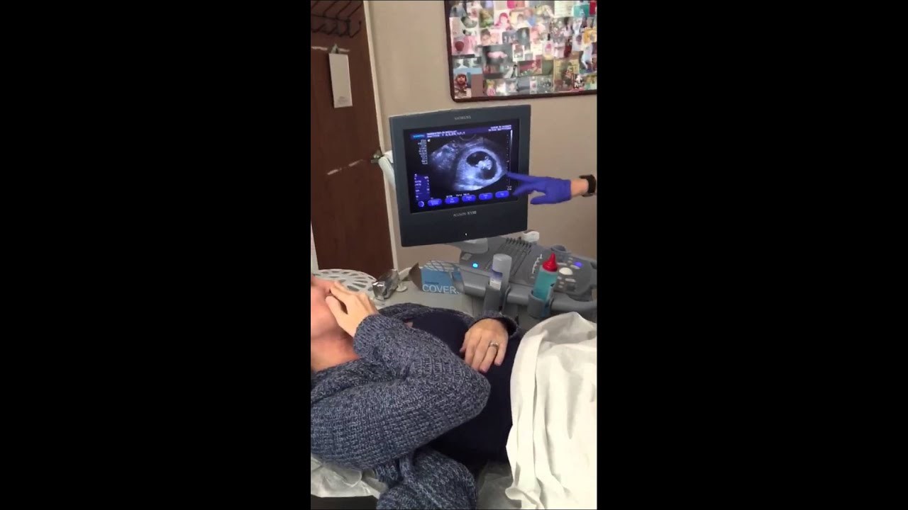 "Ma šalite se." To su bile riječi trudnice nakon što joj je doktorica potvrdila ono što je i naslućivala