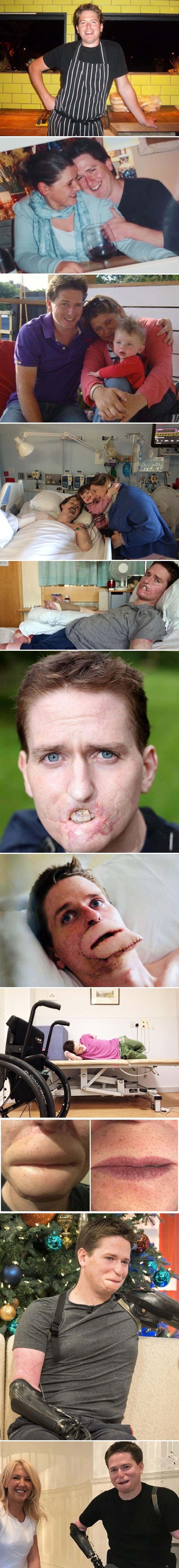 Ovog muškarca je "obična gripa" gotovo živog pojela, a sada mu je tetovaža promijenila život