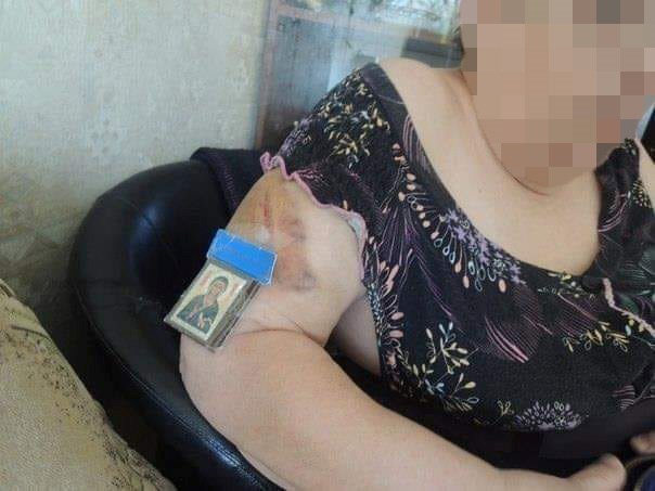 Ova baka ne vjeruje lijekovima i mastima, zalijepila je nešto drugo kako bi joj izliječilo ogromnu modricu