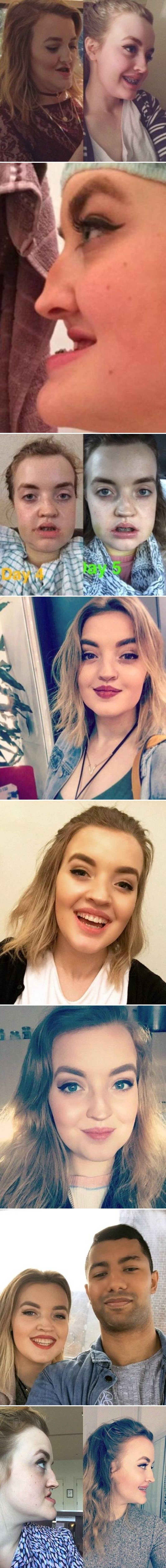 Operacija koja joj je zauvijek promijenila život: Ovoj mladoj ženi nitko više ne govori da je nakaza