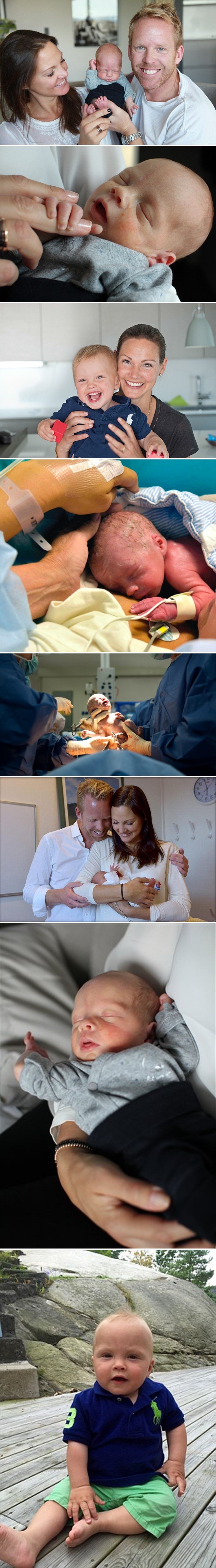 Vincent izgleda kao obična beba, no zapravo je medicinsko čudo