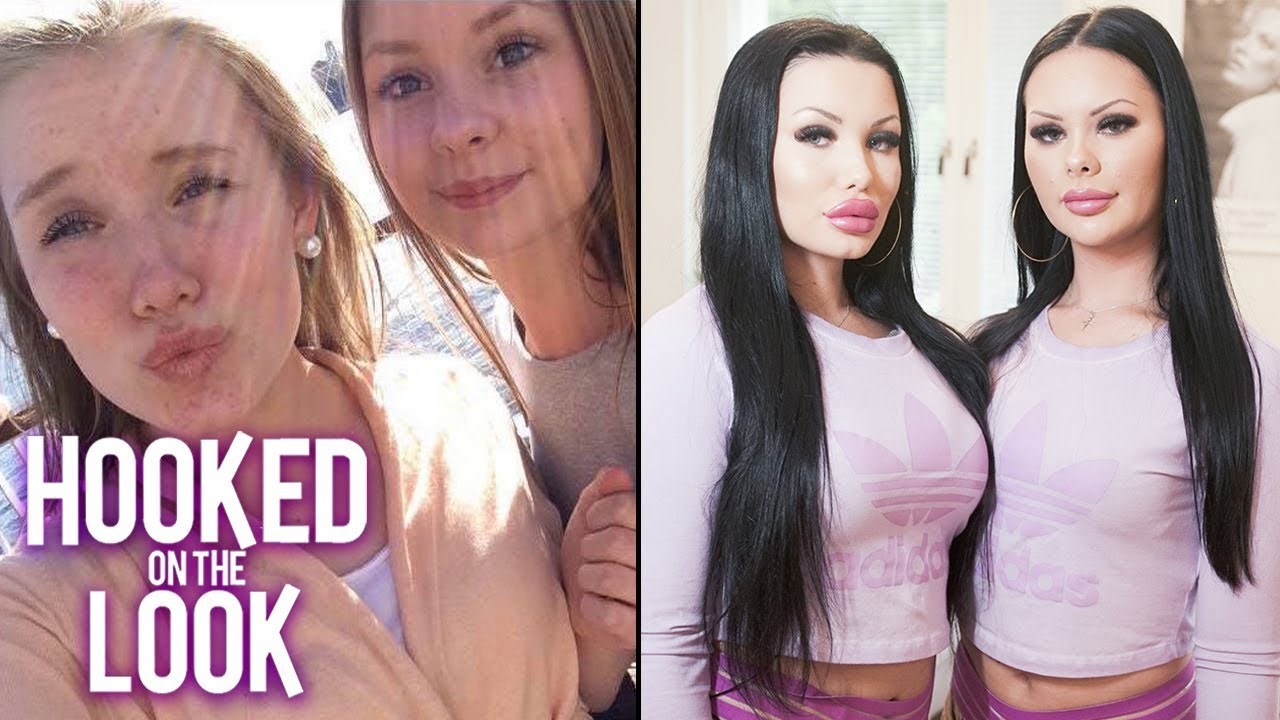 Prijateljice su prije bile sramežljive i nesigurne, danas su izoperirane i pokušavaju izgledati kao blizanke