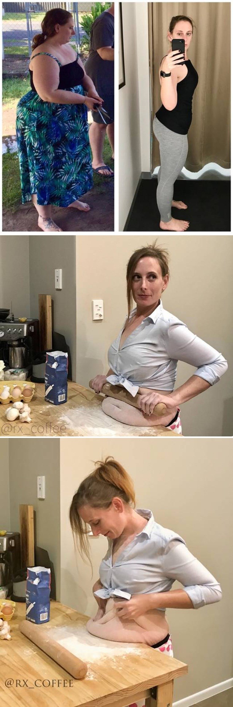 Skinula je kilograme, ali onda se pojavio novi problem koji je iskoristila kako bi nasmijala druge