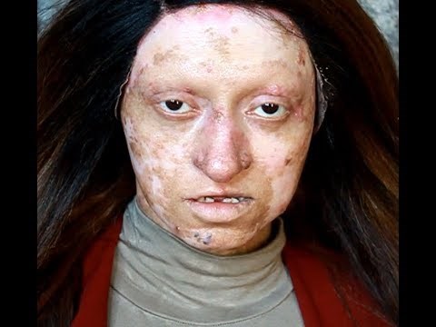 Nevjerojatna moć šminke: Ova žena ima kožnu bolest, nećete vjerovati kako je izgledala na kraju videa