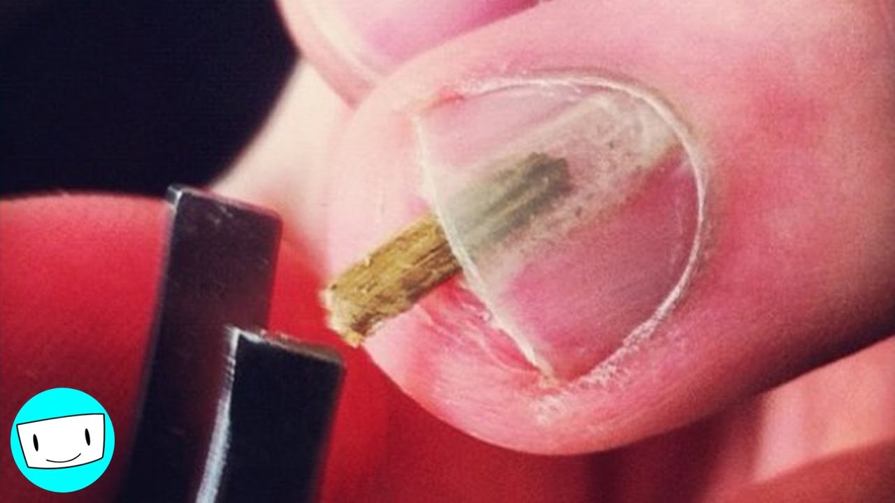 VIDEO 10 nesvakidašnjih fotografija koje će vas u sekundi uznemiriti