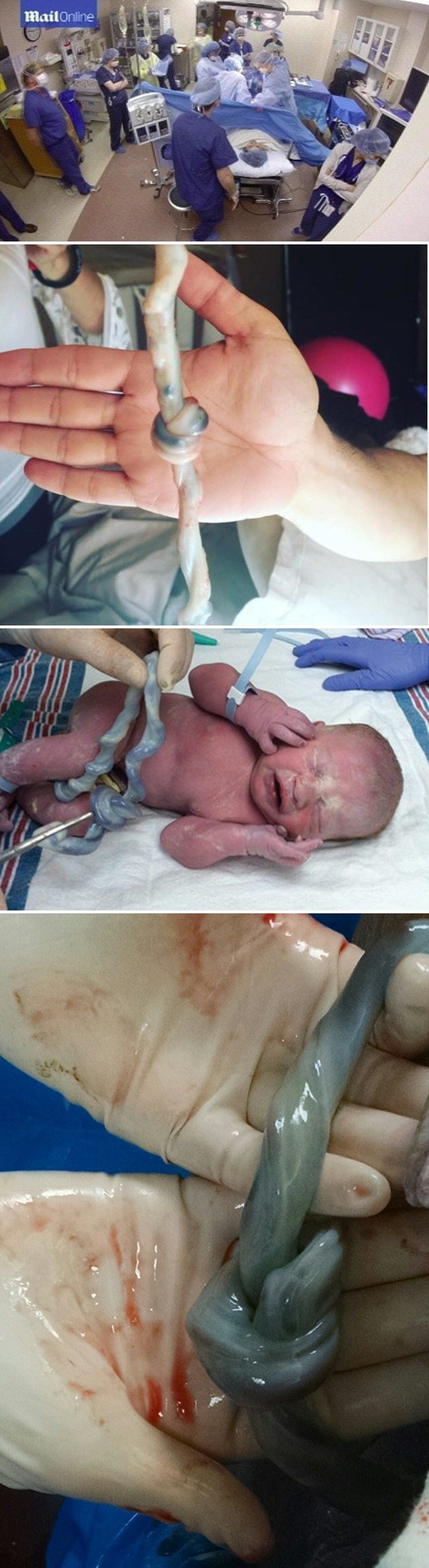 "Tata, brzo, slikaj ovo!" Žena mu je rodila zdravu bebu, doktori nisu mogli vjerovati kad su vidjeli što se dogodilo