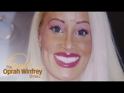 Mama koja je postala ovisnica o estetskim operacijama šokirala je svijet svojim izgledom