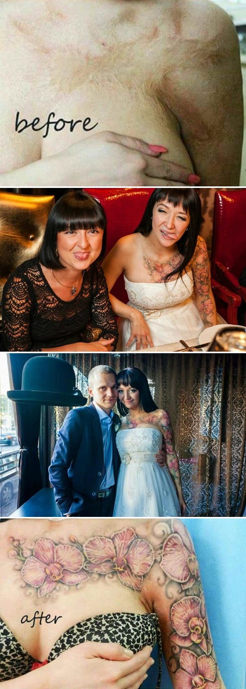 Gornji dio tijela joj je godinama bio prekriven ogromnim ožiljcima, sada je pronašla način da ih ukrasi