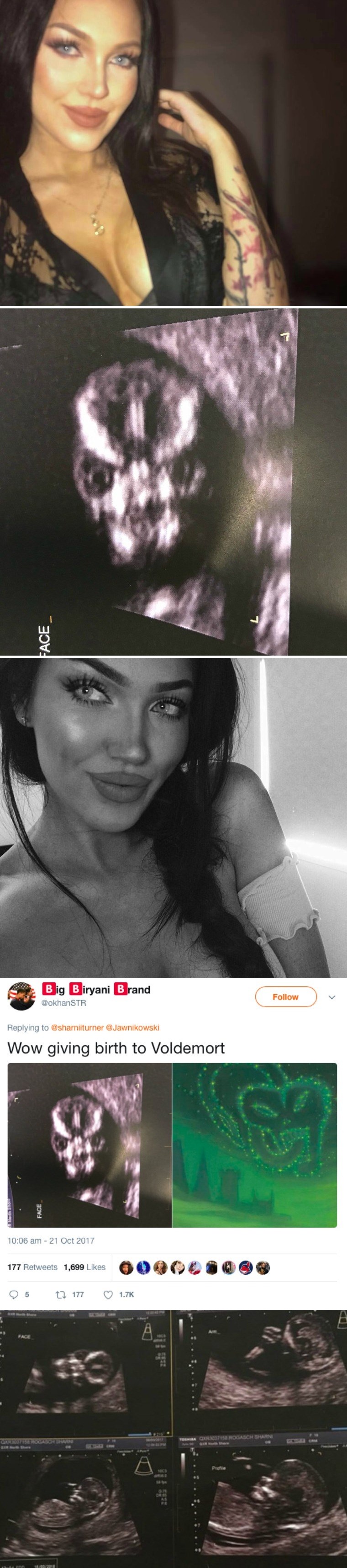 Trudnica je na internetu podijelila jezivu sliku s ultrazvuka, ljudima nije jasno što zapravo vide na njoj