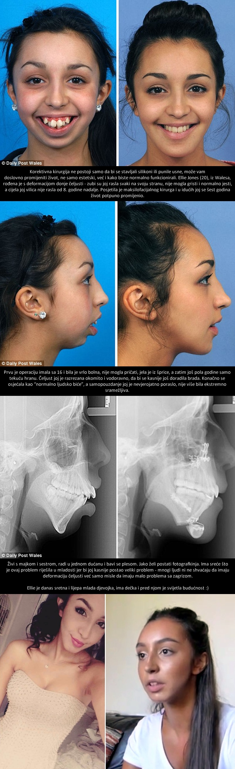 Smijali su joj se i nazivali je čudovištem, a onda je jednom kirurgu uspjelo čudo koje ju je potpuno promijenilo