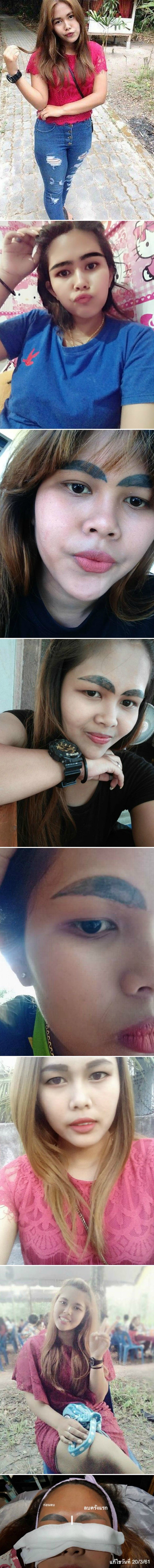 Slike prije i nakon zahvata pokazuju zbog čega ova žena nije trebala isprobati nepotrebni tretman za obrve