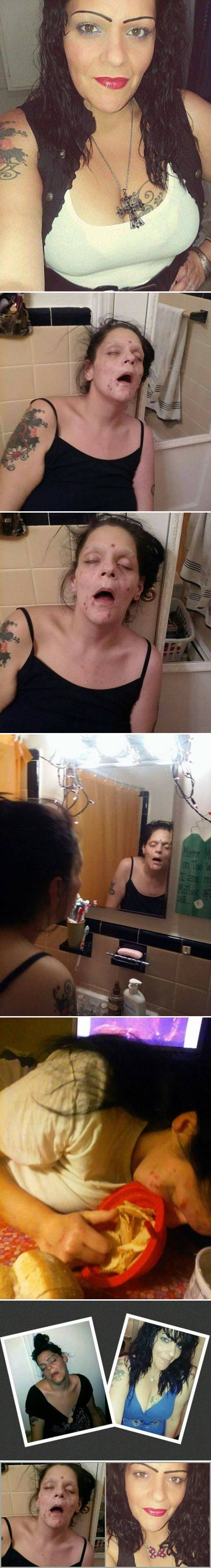 Bivša ovisnica podijelila je šokantne stare fotke kako bi svima pokazala što joj je droga učinila