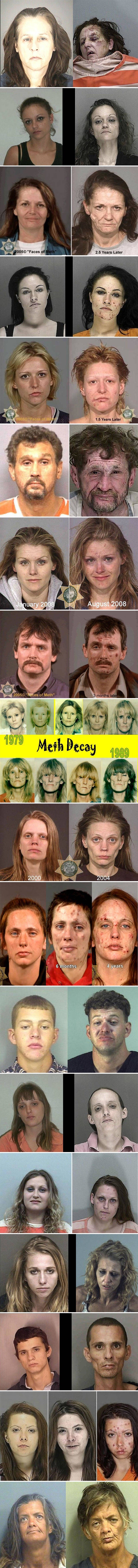 Šokantne fotografije ovisnika pokazuju što će vam se dogoditi s izgledom ako se počnete drogirati