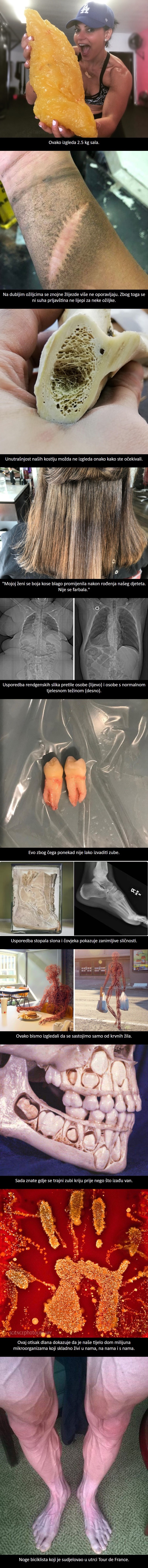 11 neobičnih fotografija koje otkrivaju vrlo zanimljive činjenice o našem tijelu