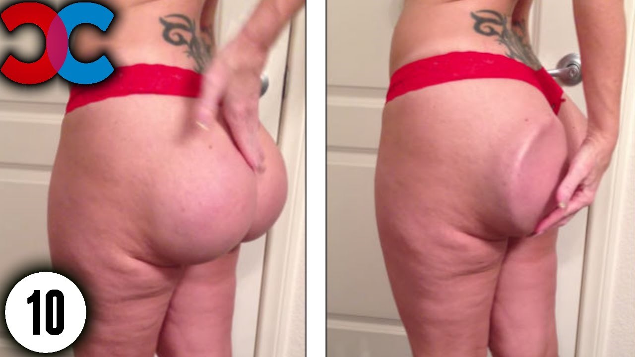 10 najgorih slučajeva u kojima su estetske operacije uništile izgled nepromišljenih osoba