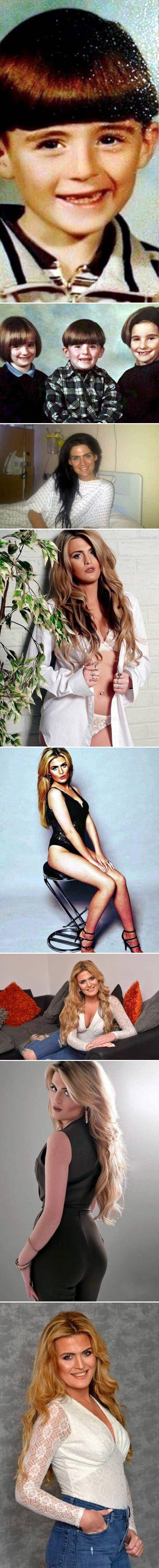 Rođena je kao muško, promijenila spol i sada smatra da partneru ne treba reći da je imala operaciju