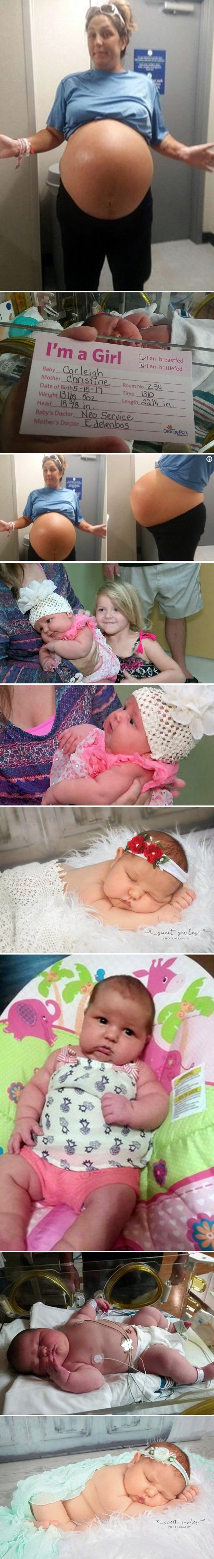 Žena s ogromnim trudničkim trbuhom rodila je bebu za koju doktori kažu da je najveća koju su ikad vidjeli