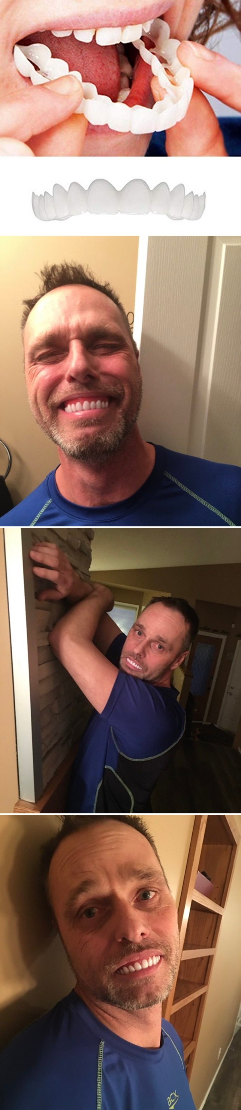 Lik je kupio navlaku za zube kako bi na fotkama imao ljepši osmijeh, rezultat je nasmijao sve osim njega