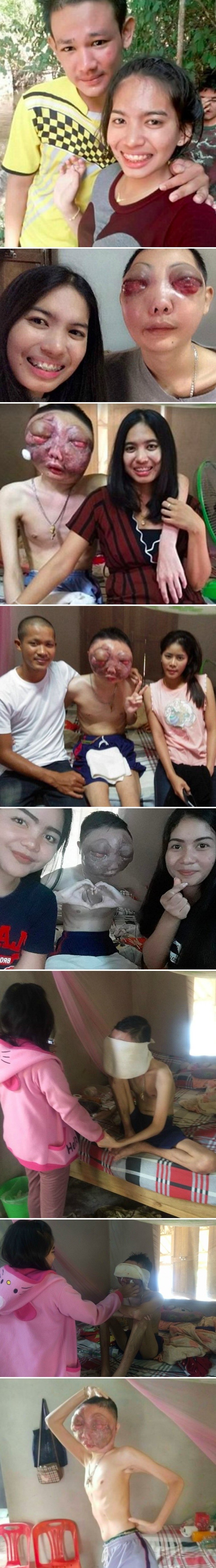 Tužna priča o djevojci koja je sa svojim dečkom ostala do samog kraja i pokazala što je prava ljubav