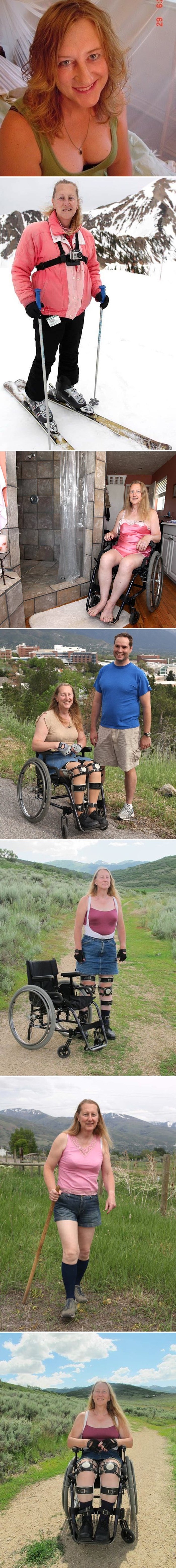 Čudna priča o ženi koja je molila doktore da joj paraliziraju noge iako je potpuno zdrava