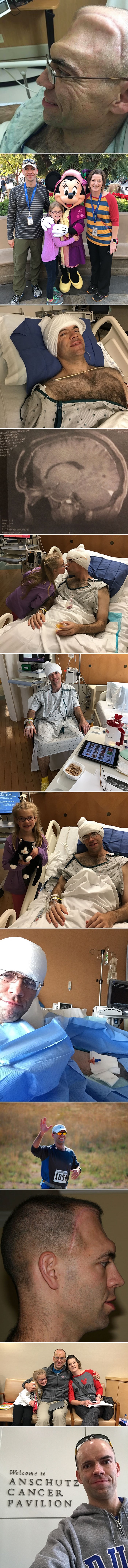 Ovaj čovjek je 4 puta pobijedio tumor na mozgu, nećak je otkrio nešto nevjerojatno o njegovoj borbi