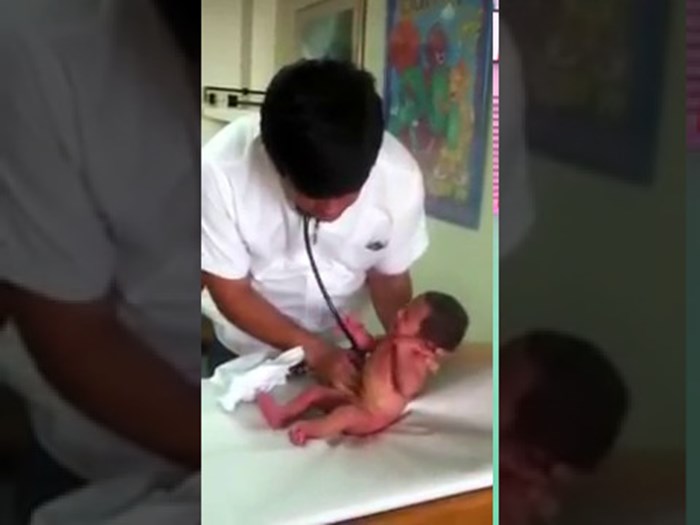 VIDEO Doktor je pregledavao bebicu, mama se začudila kad je vidjela koliko joj je dijete snažno