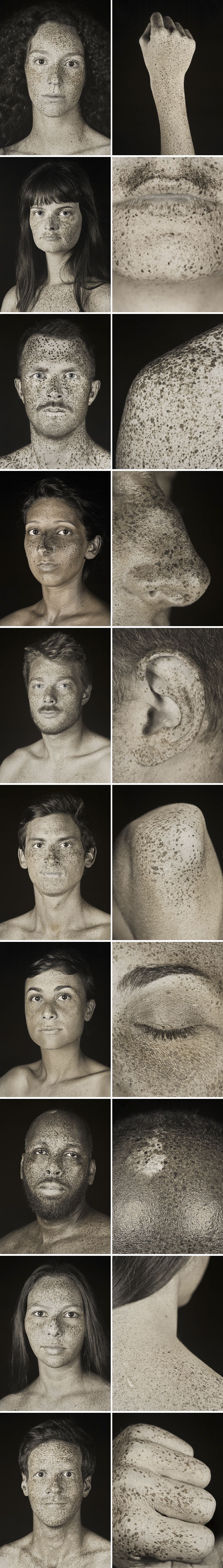 Fotograf koristi UV kamere kako bi ljudima pokazao inače nevidljive posljedice štetnog djelovanja sunca