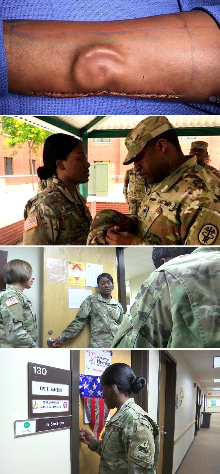 Ova mlada žena ima uho ispod kože podlaktice, a razlog bi vas mogao itekako iznenaditi