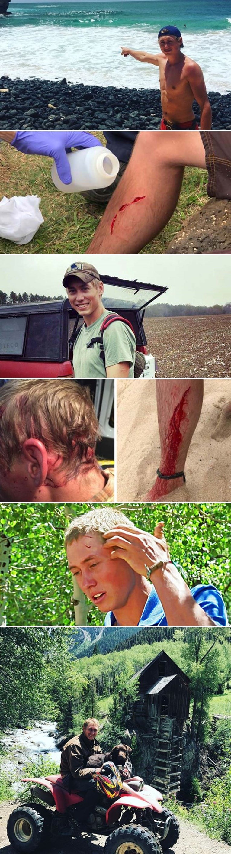 Ovo je vjerojatno jedina osoba na svijetu koja je preživjela napad medvjeda, morskog psa i zmije