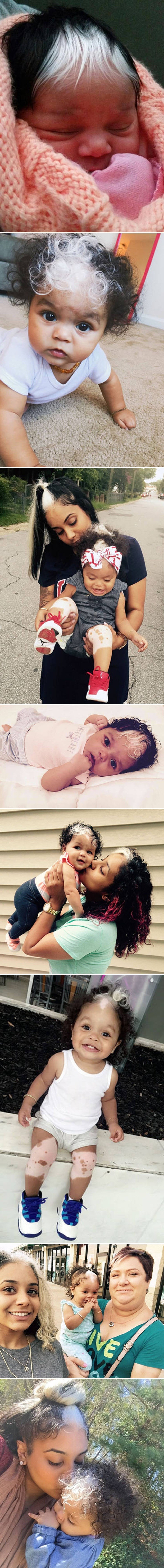 Djevojčica postala hit na internetu: Novorođenu bebu s ovakvom kosom vjerojatno nikad niste vidjeli