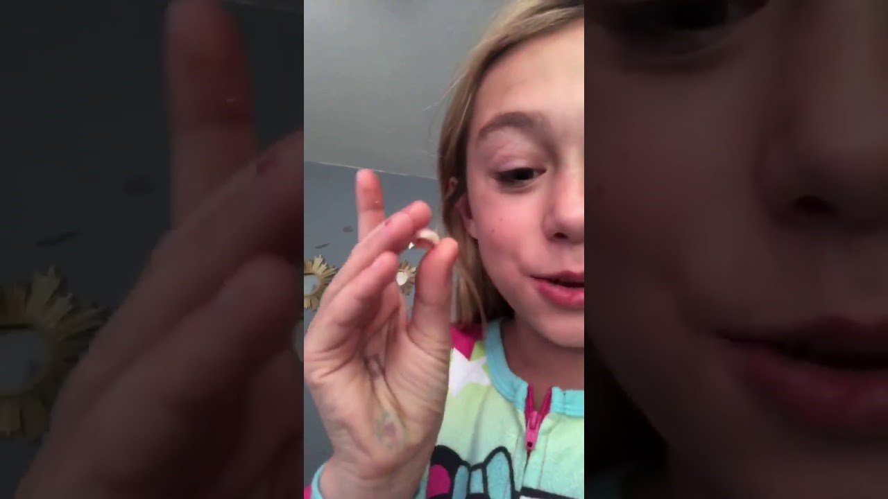 VIDEO Kakadu ljubimac pretvorio se u zubara: Djevojčica otvorila usta, on joj izvadio klimav zub!