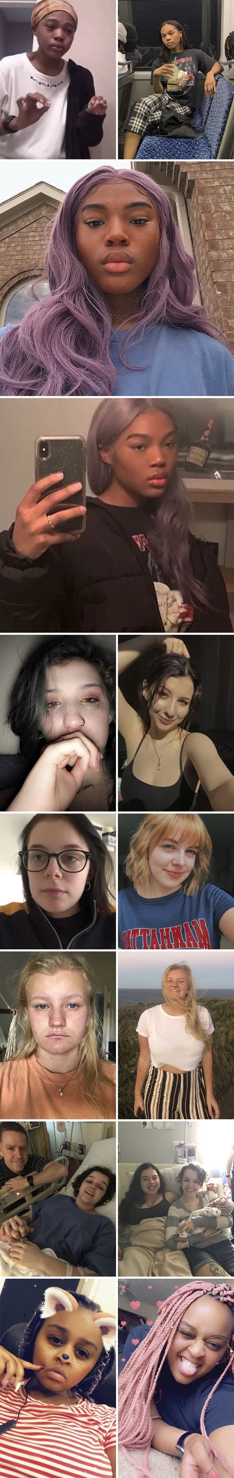 Mlada djevojka pokazala je svoje stare fotografije, usporedila ih s novim i pokazala da depresija nije kraj