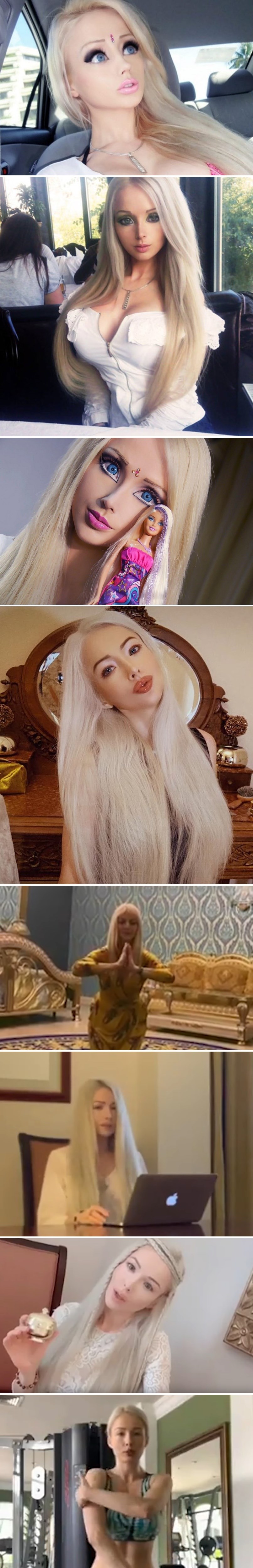 Sjećate li se još izoperirane "hodajuće Barbie lutke"? Otkrivamo kako danas izgleda i čime se bavi