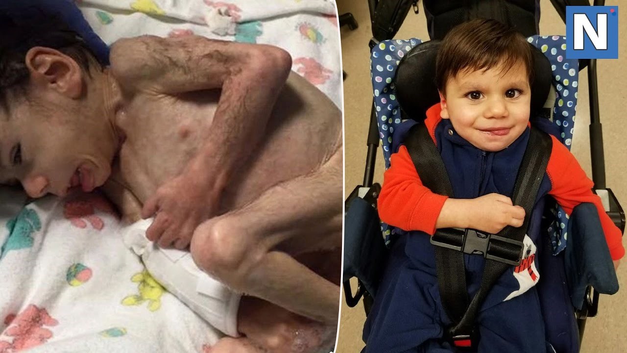 Par je posvojio gladnog dječačića iz sirotišta, nećete vjerovati kako je izgledao samo godinu dana kasnije