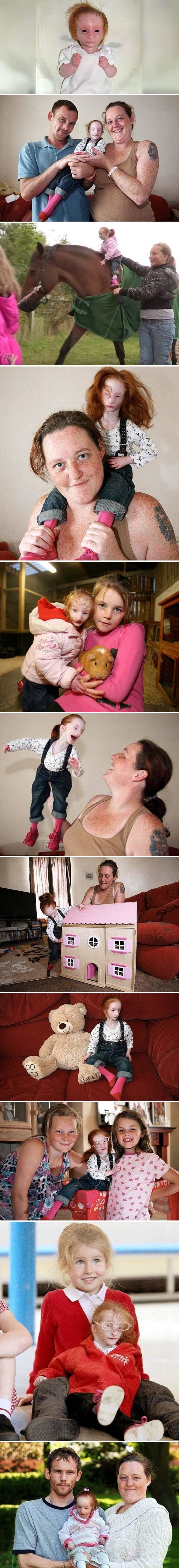 Najmanja djevojčica na svijetu ima veliku životnu priču koja je zaista čini posebnom