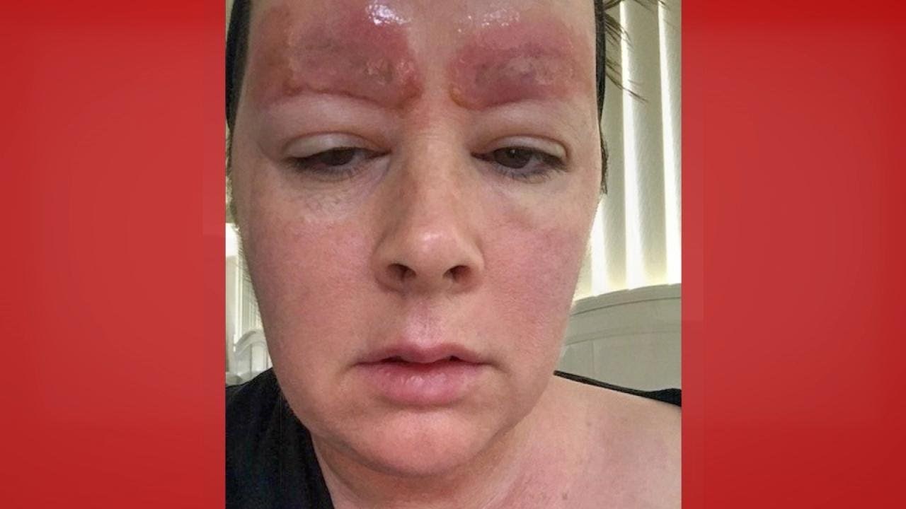 A SAMO SE HTJELA ULJEPŠATI... Pogledajte kako je žena izgledala nakon neuspjelog iscrtavanja obrva!