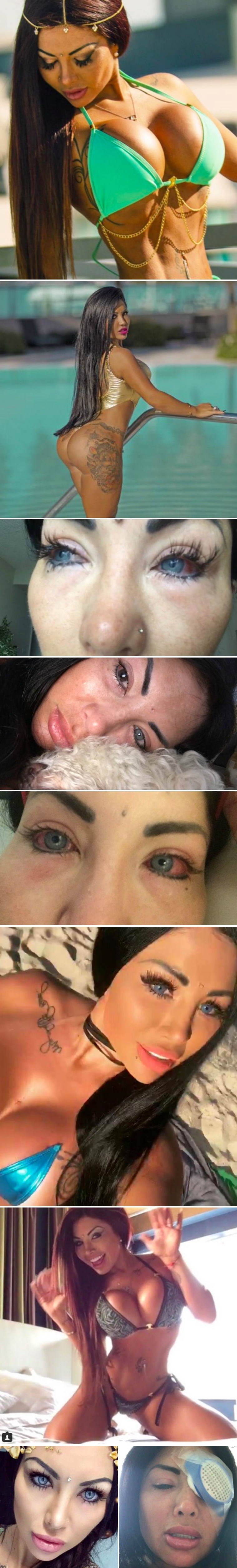 Manekenka htjela promijeniti boju očiju, otišla na operaciju nakon koje ima vidi kao 90-godišnjakinja